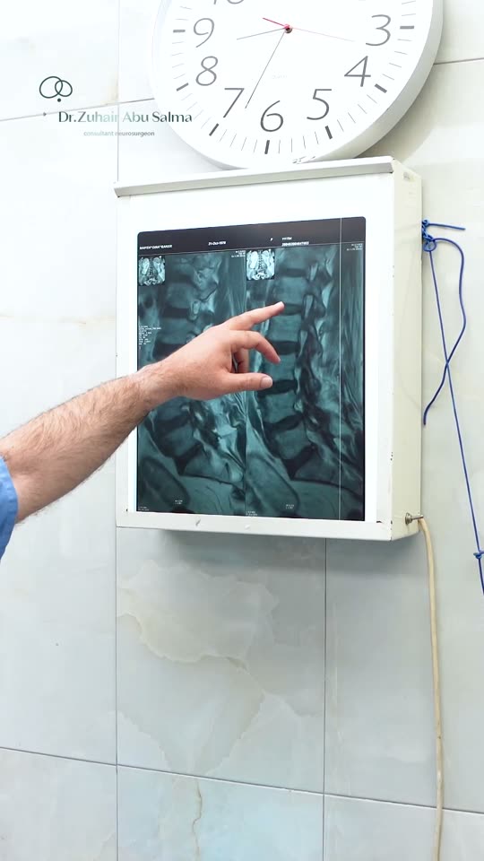 When Back Pain Isn’t Just a Disc: Other Spinal Sources Worth Looking For