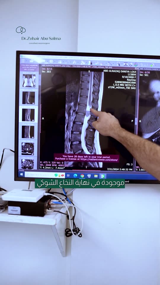 Video poster